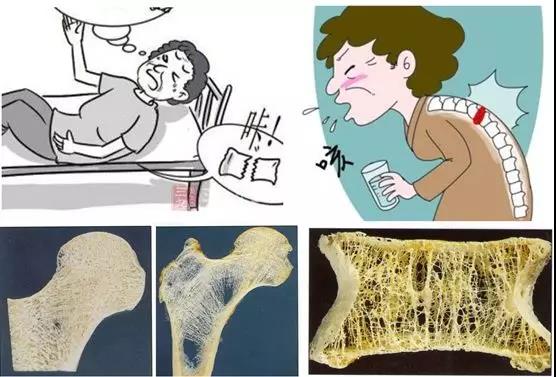 膝關(guān)節(jié)的保養(yǎng)，收藏這篇就夠了 