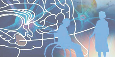 頻繁忘事、詞不達意、性情大變……這些癥狀須重視