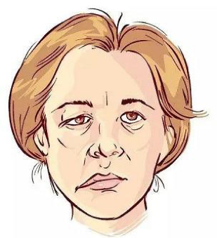 想知道自己有沒有卒中風險？內(nèi)有自測題