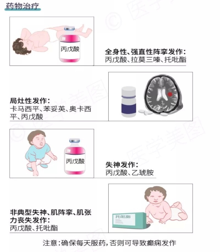  面對癲癇發(fā)作患者，該如何施以援手？ 