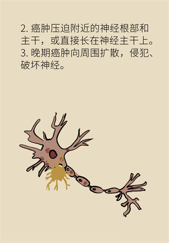 癌癥到底有多痛？需要注意這7個重點問題