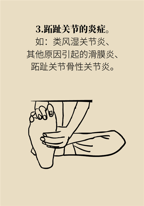 前腳掌起老繭并疼痛？當(dāng)心這可能是跖痛癥