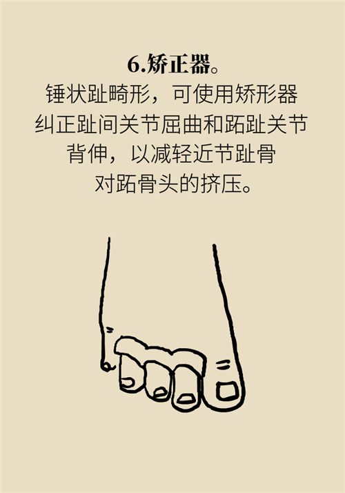 前腳掌起老繭并疼痛？當(dāng)心這可能是跖痛癥