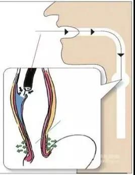 駐馬店市中心醫(yī)院成功開展POEM手術(shù)治療賁門失弛緩癥