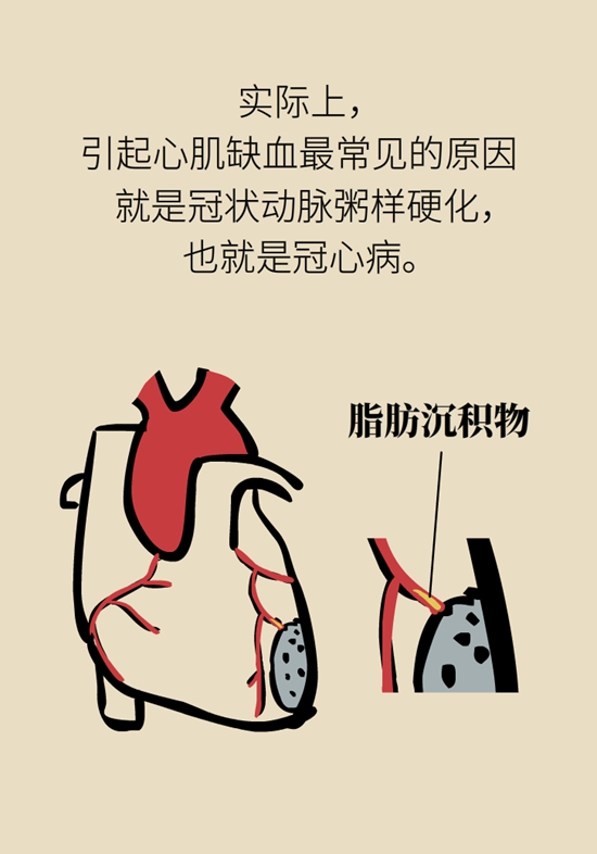 這一類人不適合用速效救心丸，快來(lái)自測(cè)一下