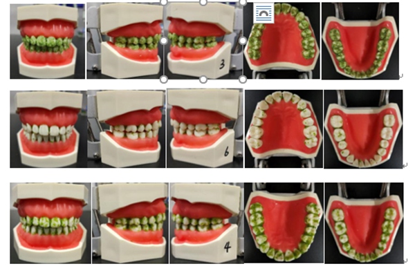 電動(dòng)牙刷怎樣選？中消協(xié)發(fā)布比較試驗(yàn)結(jié)果和消費(fèi)提示