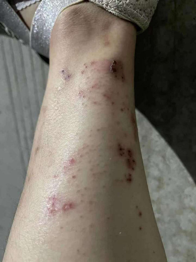 姑娘，你變“丑”了，卻是我們眼中最美的天使