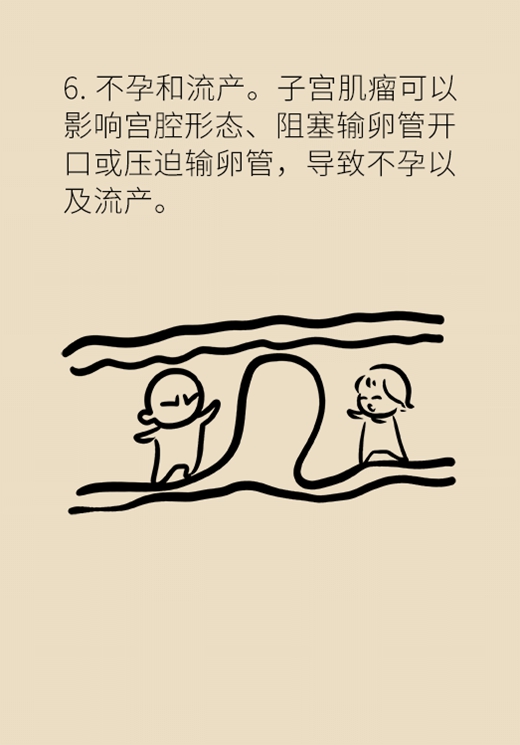 關(guān)于子宮肌瘤，最全的知識(shí)在這里