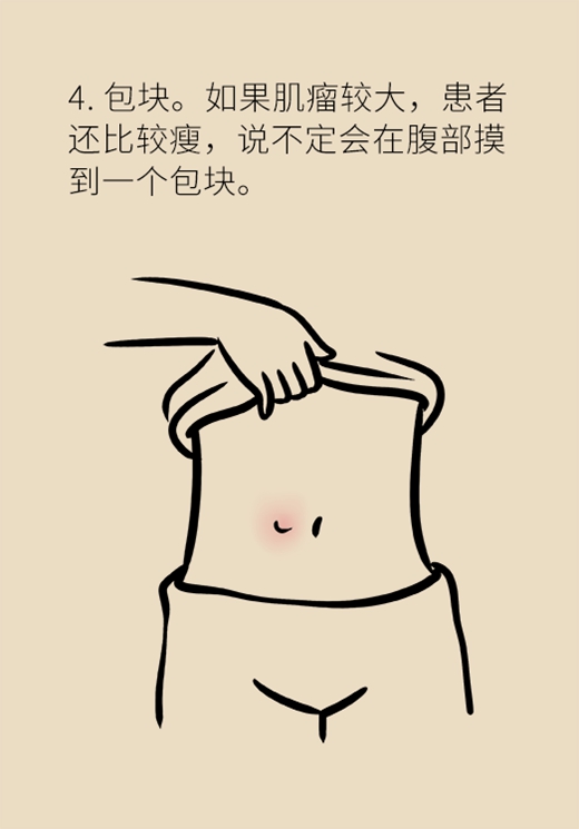 關(guān)于子宮肌瘤，最全的知識(shí)在這里