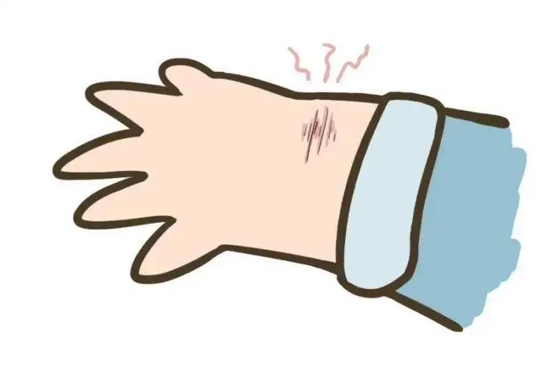 協(xié)和急診:一文詳解常見外傷應(yīng)如何處理