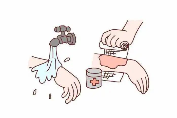 協(xié)和急診:一文詳解常見外傷應(yīng)如何處理