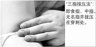 抽血后胳膊一片青是血管細(xì)？多半是你沒壓對