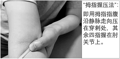 抽血后胳膊一片青是血管細(xì)？多半是你沒壓對