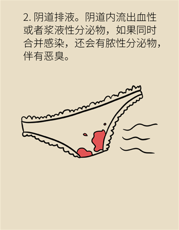 體重超過(guò)這個(gè)指標(biāo)，竟然會(huì)得這種婦科癌癥？