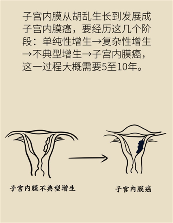 體重超過(guò)這個(gè)指標(biāo)，竟然會(huì)得這種婦科癌癥？