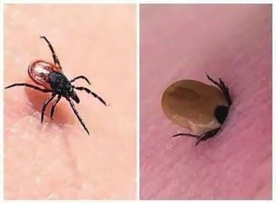 被蜱蟲“?！鄙虾堋耙?？別慌 省疾控專家：一旦有不明原因發(fā)熱，需盡早去醫(yī)院，這種病治愈率很高