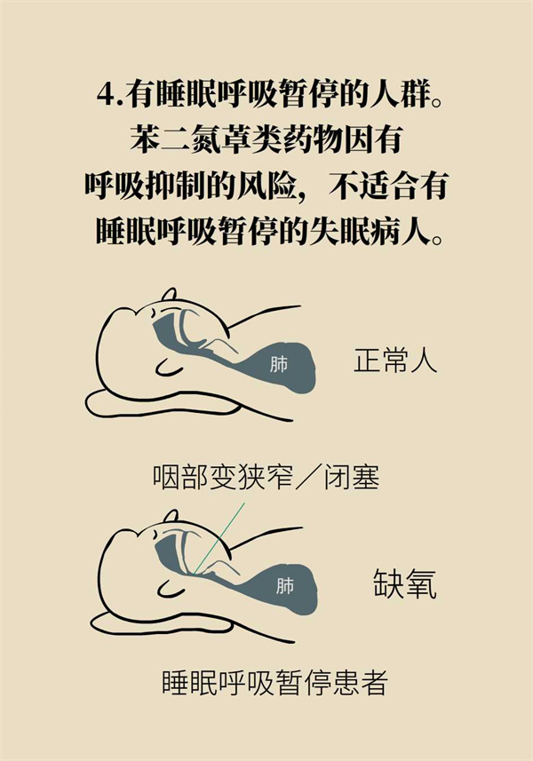 失眠人群都適合吃安眠藥？這五類人尤其注意