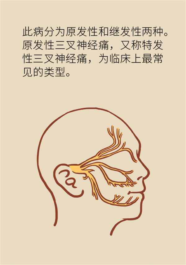 這種疼痛不是牙疼？緩解三叉神經(jīng)痛就用這兩招