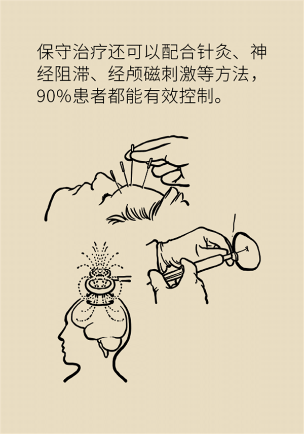 這種疼痛不是牙疼？緩解三叉神經(jīng)痛就用這兩招