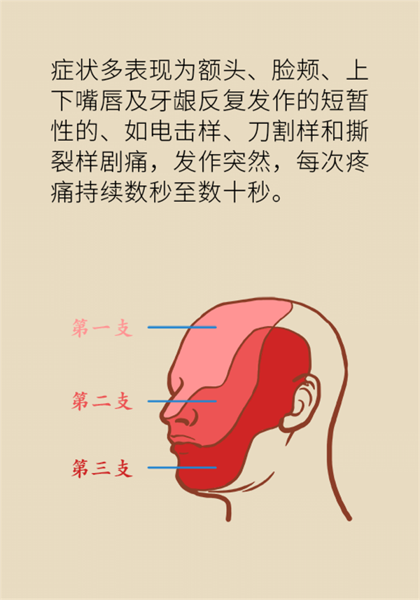 這種疼痛不是牙疼？緩解三叉神經(jīng)痛就用這兩招