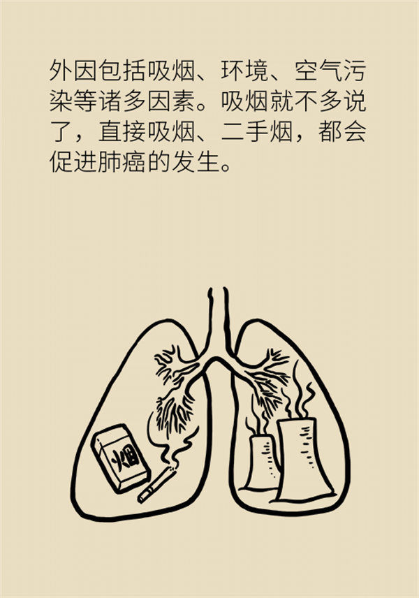 肺部結節(jié)會變成肺癌嗎？這些人群要警惕