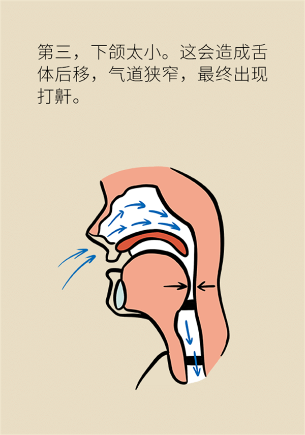 睡覺打鼾怎么辦？6個小妙招輕松緩解
