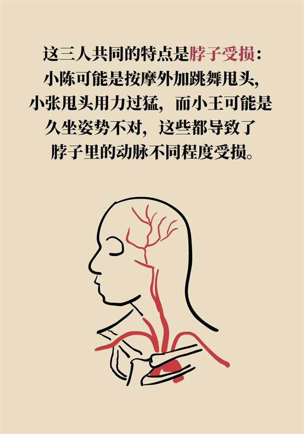 這個動作讓多名年輕人中風了，一定要重視！