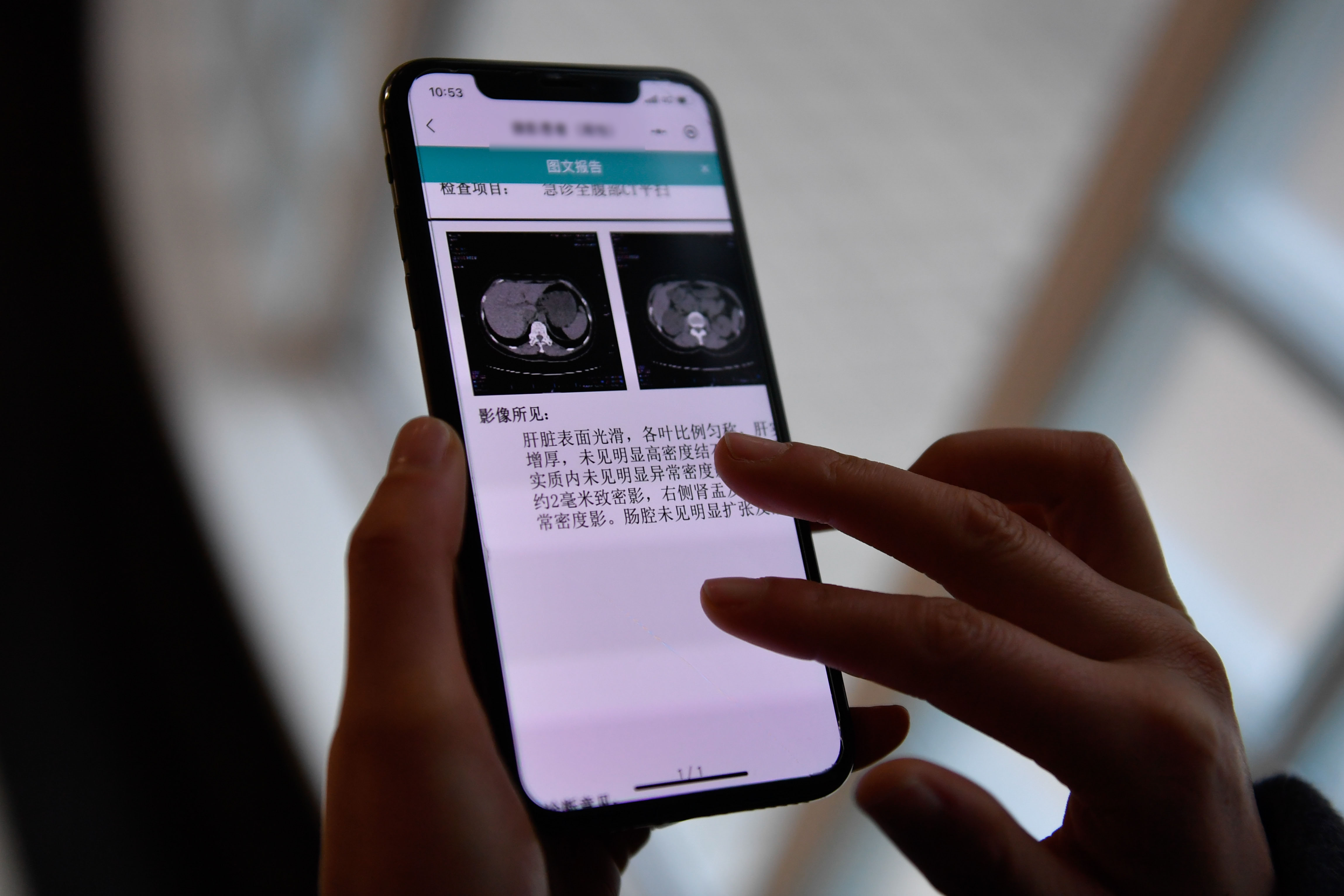 “現(xiàn)代化最重要的指標(biāo)還是人民健康”——寫在第15個全民健身日之際