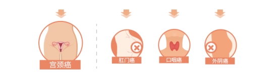 宮頸癌發(fā)病呈年輕化趨勢？請收好預(yù)防指南