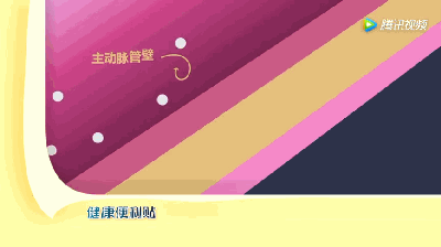 5天接診4例A型主動脈夾層，到底有多兇險