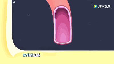 5天接診4例A型主動脈夾層，到底有多兇險