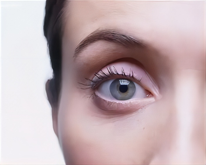 假期長(zhǎng)時(shí)間追劇造成眼干燥癥 女子眼睛刺痛淚流不止