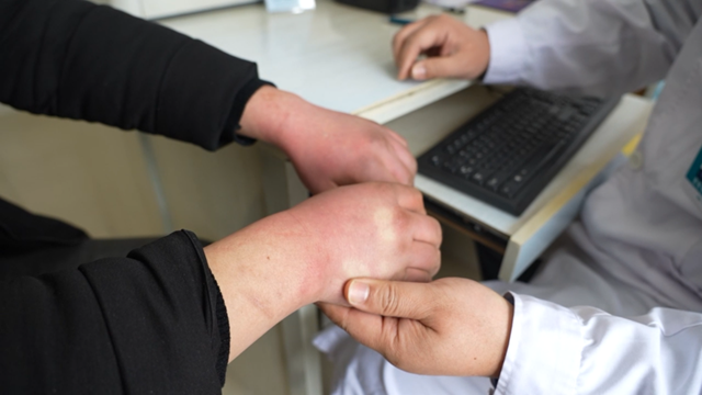 為什么過敏總發(fā)生在春季？聽聽專家解答