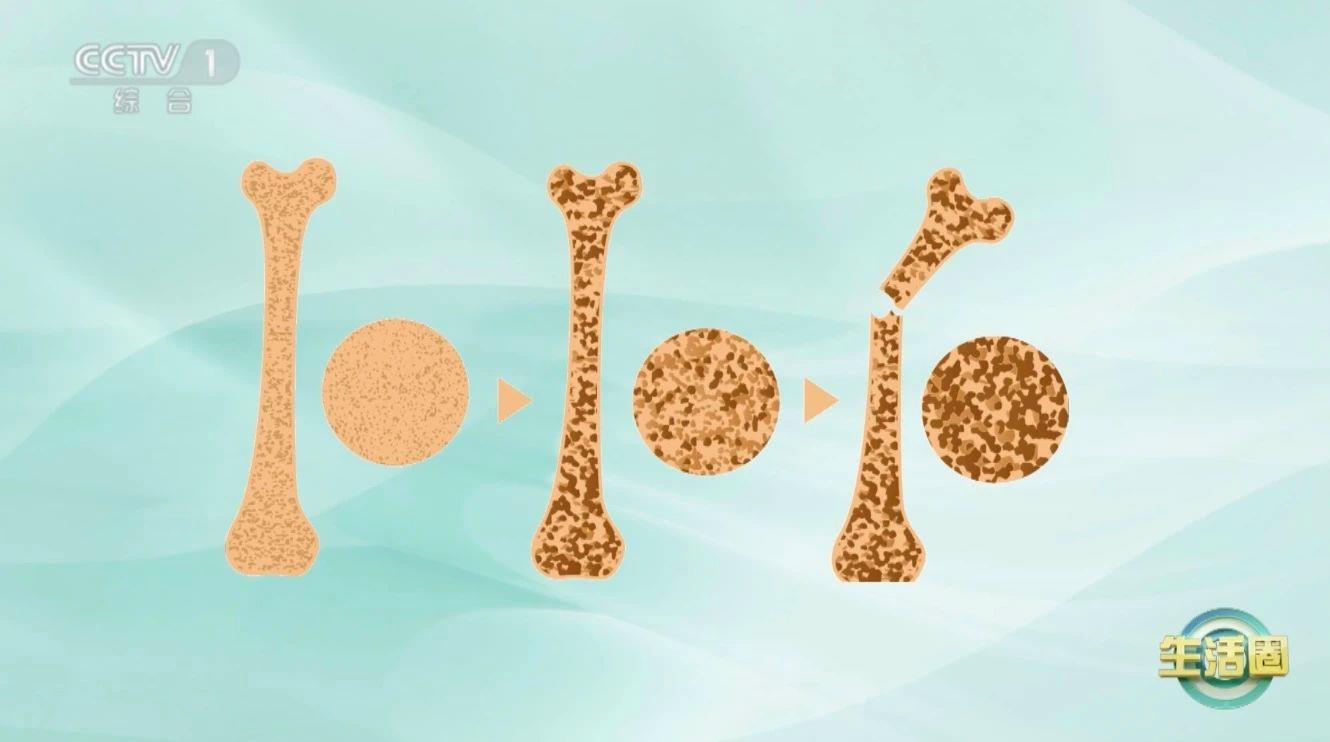 血管堵沒堵？走兩步！出現(xiàn)這6個信號就要當(dāng)心