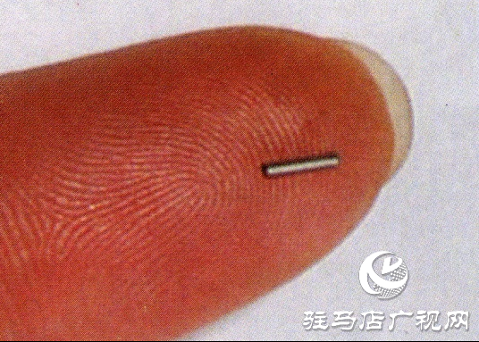 駐馬店市第一人民醫(yī)院：小粒子新突破，腫瘤放療科成功開展放射性粒子植入術(shù)