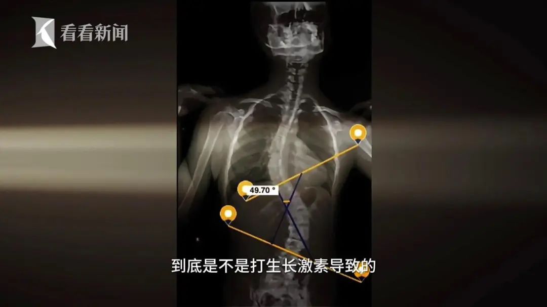 焦慮的家長擅自給孩子打“增高針”，醫(yī)生：需專業(yè)評估否則存風(fēng)險