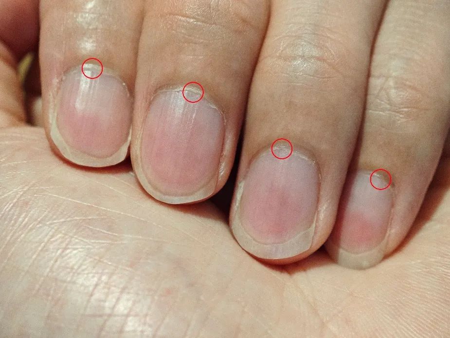 手指也會(huì)感染HPV？這件事很多女生都愛(ài)做，一定要注意