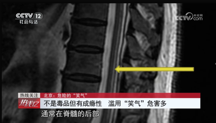  成癮、致幻，嚴重可致死！它不是毒品，卻像毒品一樣危險