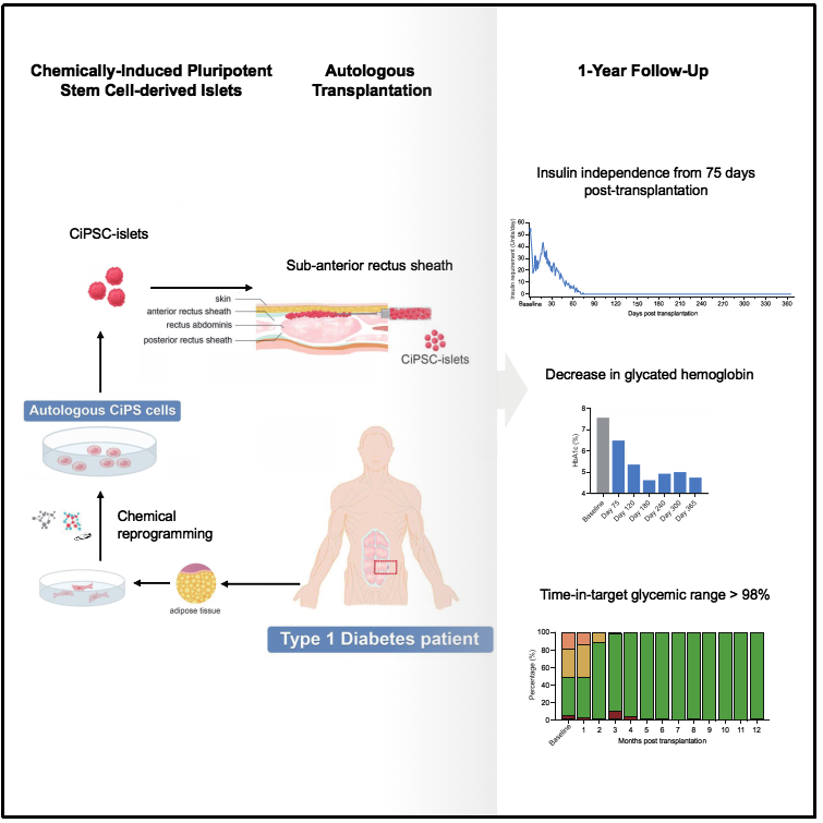 事關(guān)糖尿病治療，我國科學(xué)家取得突破