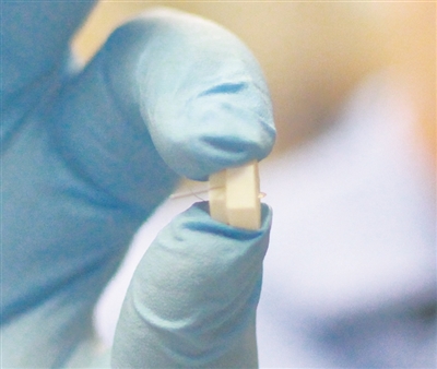 植入式傳感器可持續(xù)監(jiān)測炎癥水平