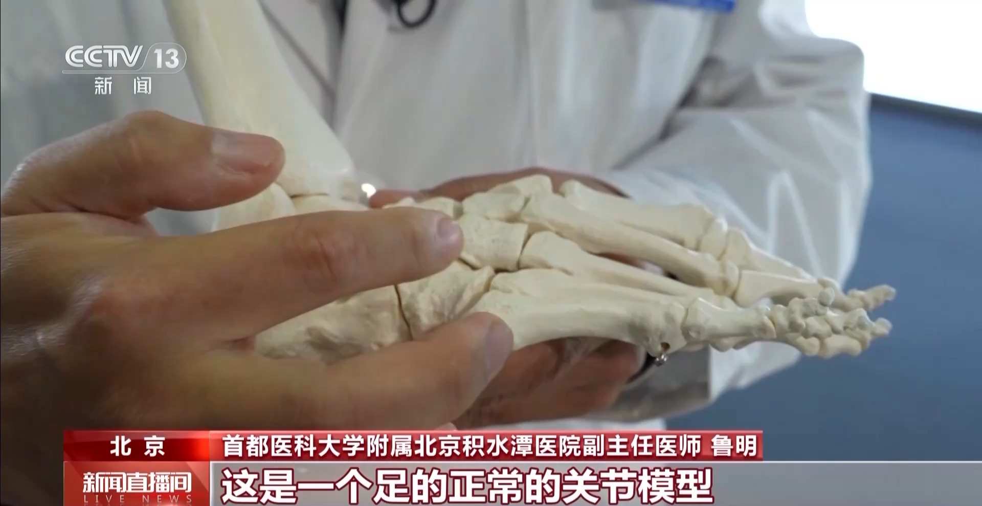 瘋狂種草碳板跑鞋？醫(yī)生：足底筋膜炎警告！