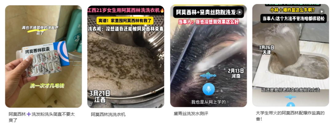 用阿莫西林洗頭，能治療脫發(fā)？別信！