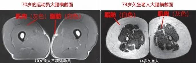 運動是加速衰老，還是延緩衰老？真相揭開