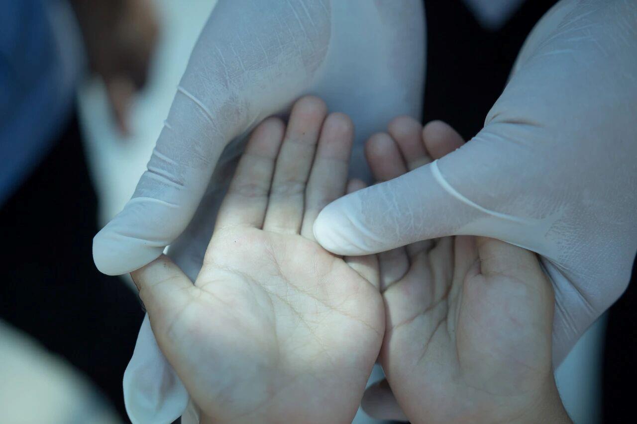 關(guān)于手足口病的8個常見誤區(qū)，一次說清！