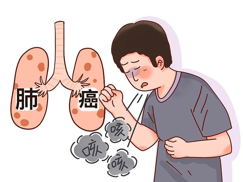 肺癌一發(fā)現(xiàn)就是晚期？身體給出的暗示，不要忽視