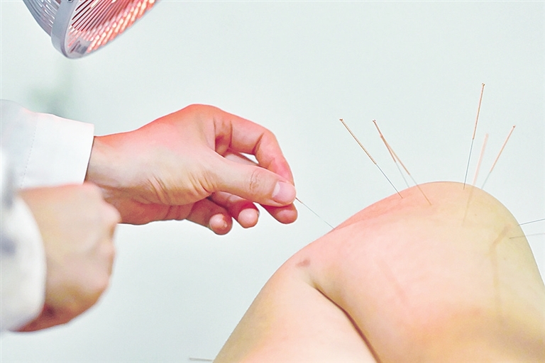 針灸調(diào)理 重在得氣