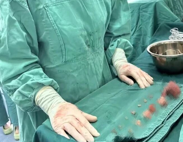 15顆肌瘤，毫米級(jí)“排雷”——駐馬店市中醫(yī)院為患者圓健康夢(mèng)