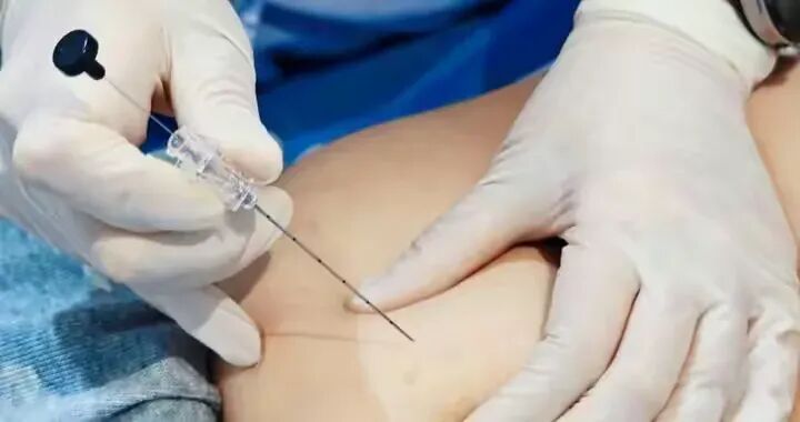 早春二月&ldquo;輕身&rdquo;正當(dāng)時(shí) 駐馬店市中醫(yī)院推出中醫(yī)穴位埋線(xiàn)減肥法