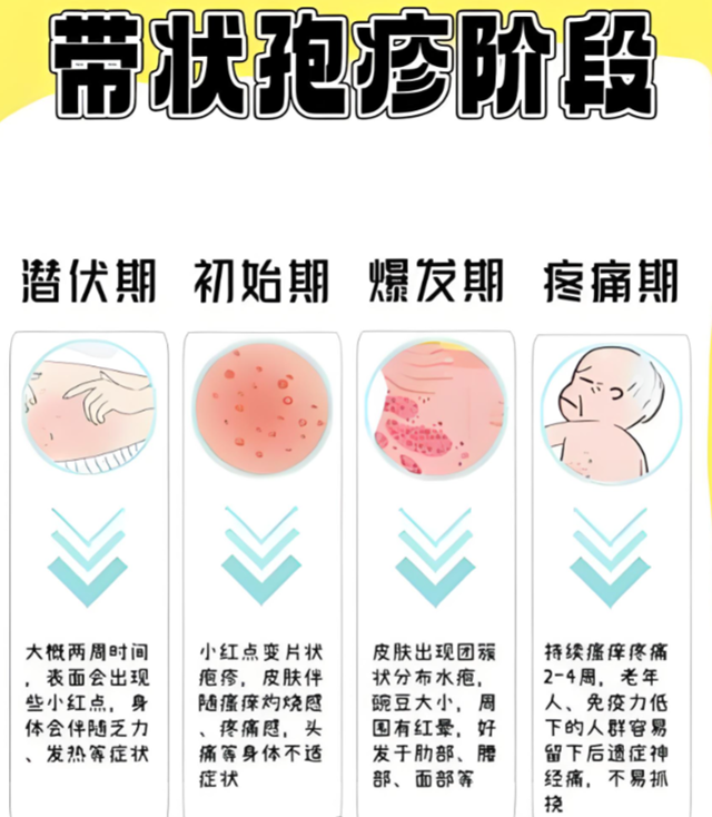  帶狀皰疹進(jìn)入高發(fā)期 專家提醒：預(yù)防勝于治療，接種疫苗最有效